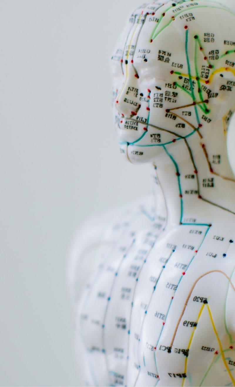 Acupuncture Acupuncture
