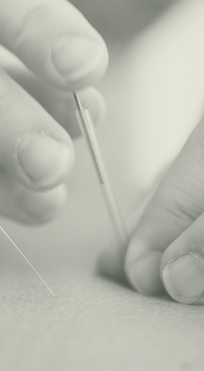 About Hands Performing Acupuncture Treatment