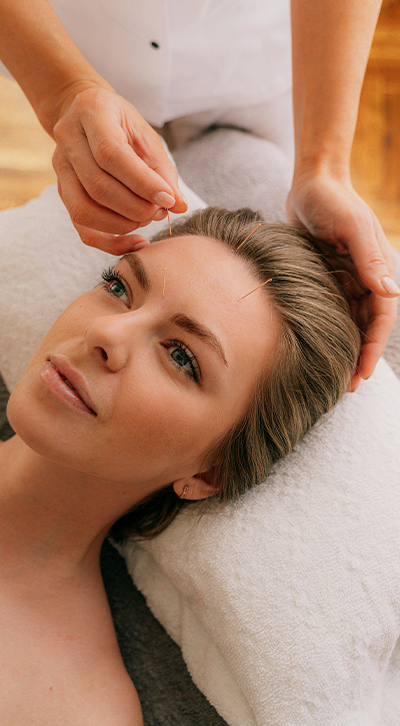 About Acupuncture Treatment On A Patient.