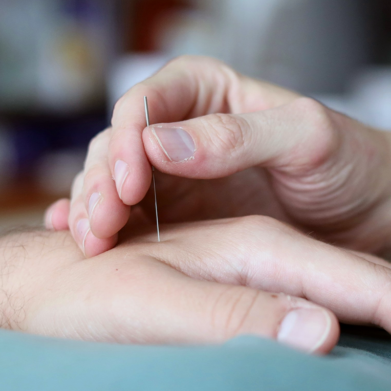 Welcome Needle Insertion During Acupuncture Treatment